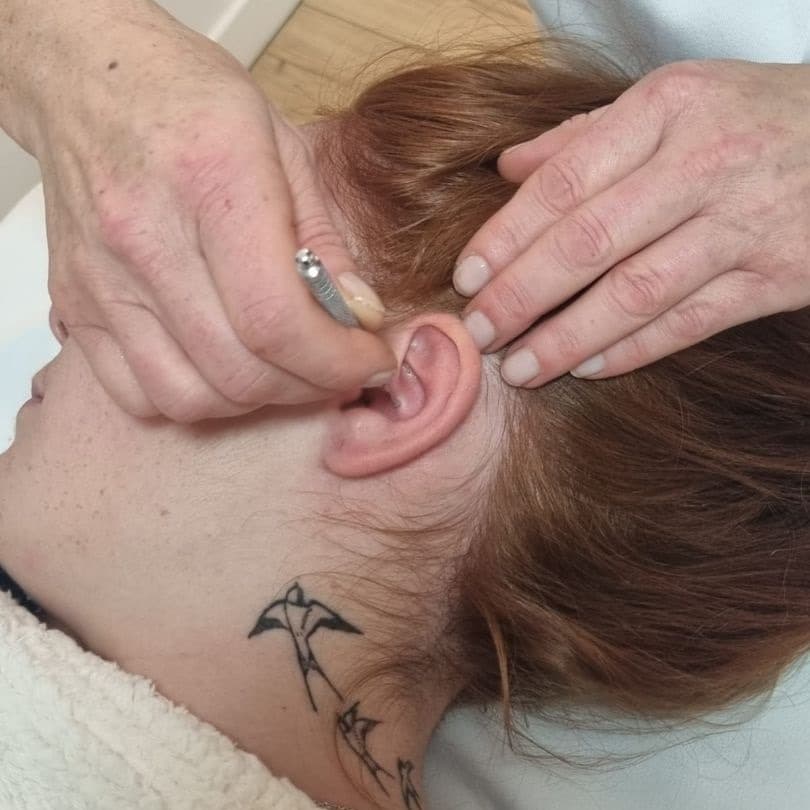 Stimulation des zones réflexes de l'oreille